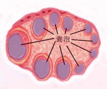 多囊明明有那么多卵泡，为啥还难怀孕？