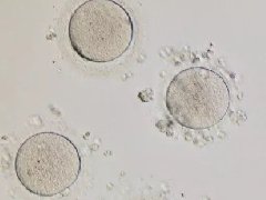 <b> AMH正常，取的却是空卵泡？我该怎么办？</b>