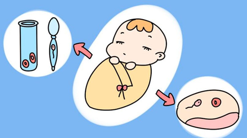 做试管婴儿取卵的时候疼吗,取卵后注意事项主要