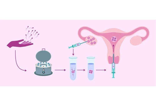 做试管婴儿胚胎移植时间可以选择吗？