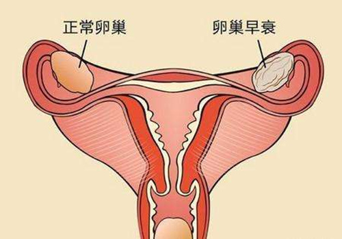 女性卵巢早衰能怀孕的几率有多大